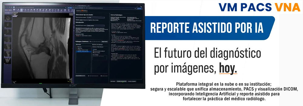 mejoras_IA_2026